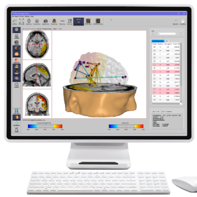 specialist in neurofeedback neurofeedback training
