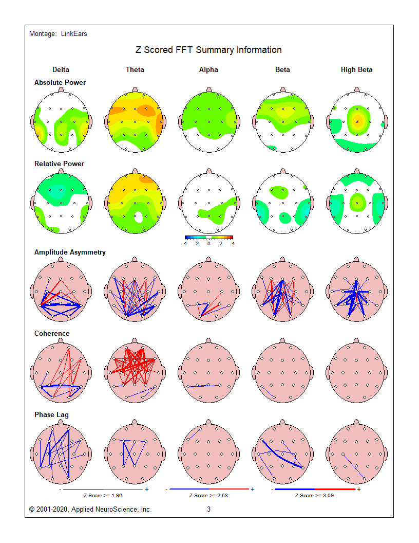 neurofeedback-behandeling-hoofdjes neurofeedback behandeling
